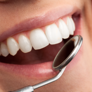 Zahnarzt Spiegel Yellow